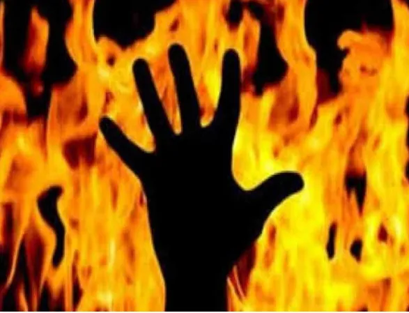 प्रेम प्रसंग में युवक-युवती ने खुद को लगाई आग, युवती की दर्दनाक मौत