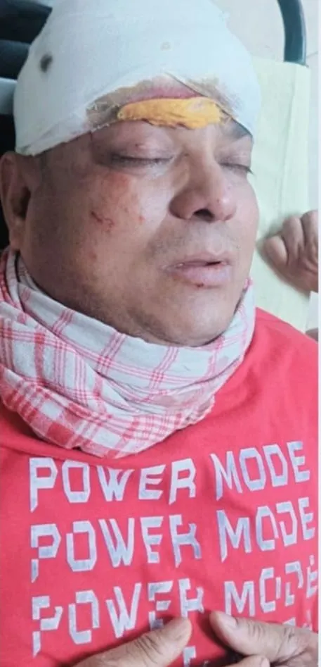 अंचलाधिकारी की गाड़ी में टेलर ने मारी जोरदार टक्कर, दो सीओ जख्मी