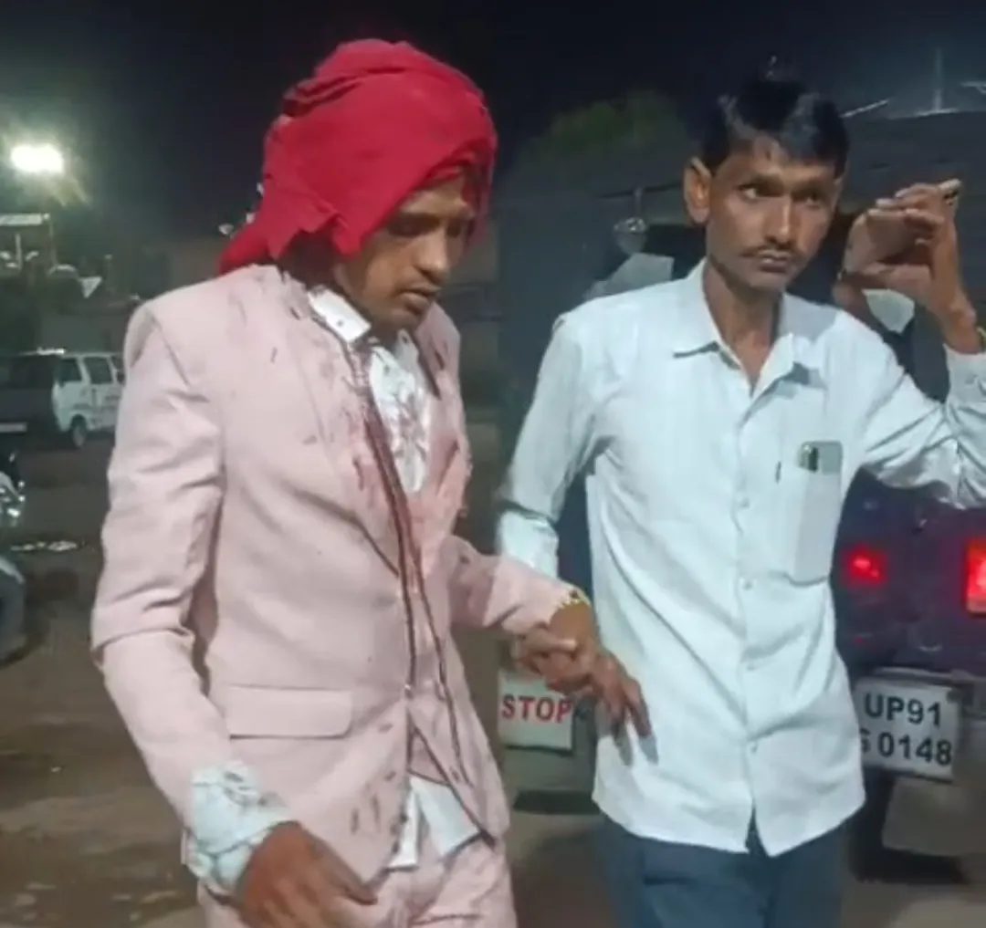 दर्जनों युवकों ने दूल्हे और बारातियों पर किया जानलेवा हमला, मुकदमा दर्ज