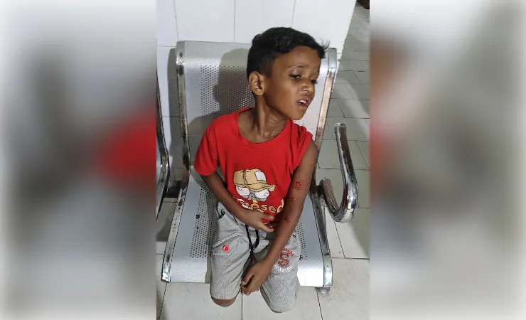 भागलपुर: खेल रहे मासूम पर कुत्ते ने किया हमला, कई जगह काटकर किया घायल