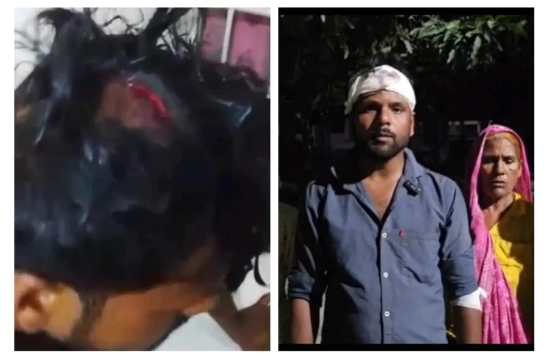 जानलेवा हमले के बाद भी एफआईआर नहीं, एसपी के दरबार पहुंचा पूरा परिवार