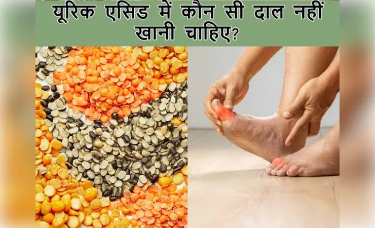 हाई यूरिक एसिड के मरीज को कौन सी दाल खानी चाहिए ?