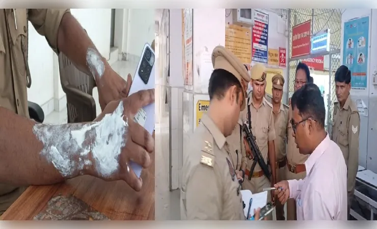 पत्नी से विवाद के बाद युवक ने थाने के बाहर खुद को लगाई आग, बचाने में थाना प्रभारी समेत तीन पुलिसकर्मी झुलसे