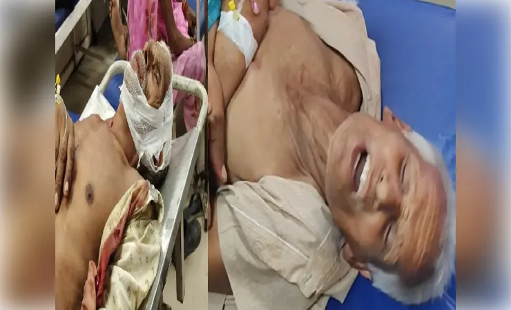 हाथरस में दो सगे भाइयों पर ताबडतोड़ फायरिंग, घायलों का अस्पताल में चल रहा उपचार
