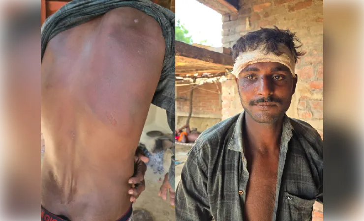 जुए के विवाद ने लिया हिंसक रूप, रेलवे लाइन किनारे मरणासन्न छोड़ भागे आरोपी