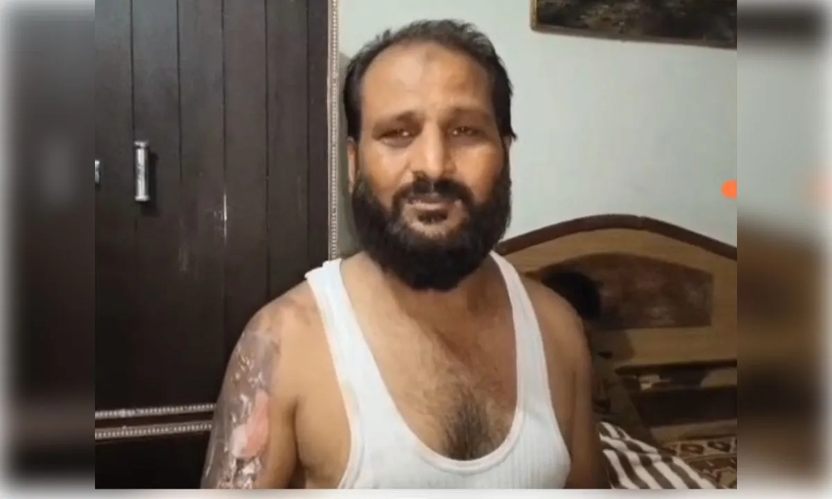   बच्चे को थप्पड़ मारने का विरोध करने पर परिवार पर फेंकी खौलती चाय, दादी, पिता और भाई झुलसे