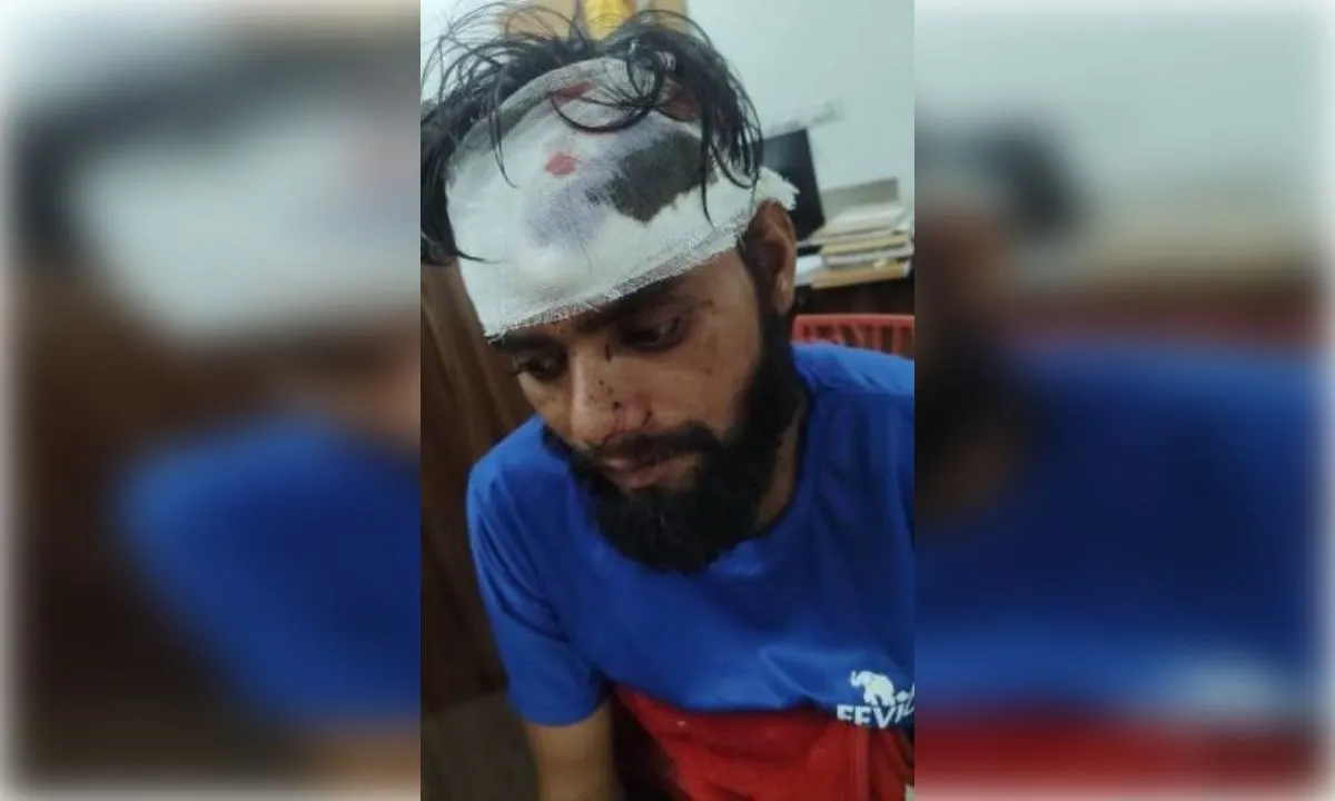 घरेलू विवाद में पिता- बेटे में नोकझोंक, बेटे पर लोहे के सरिए से हमला