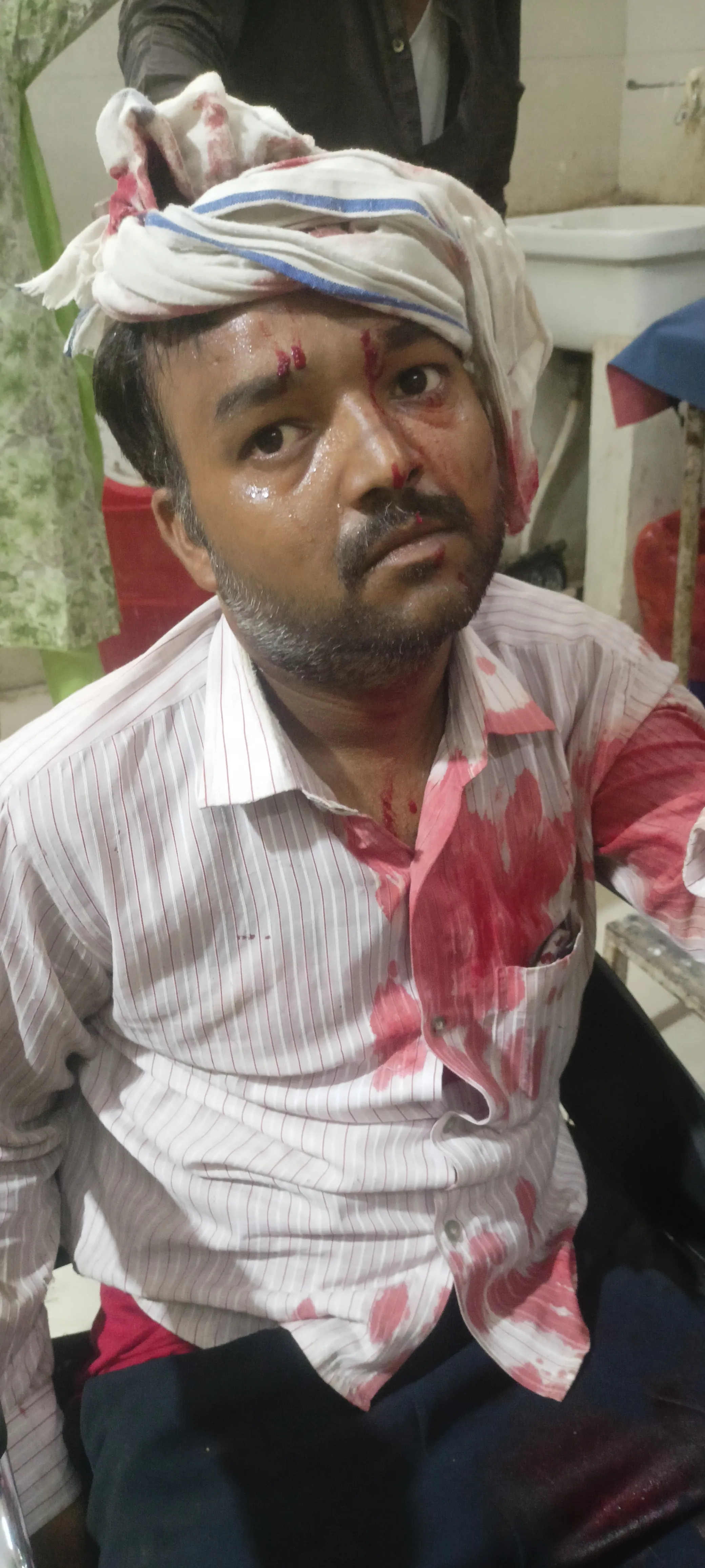 निर्माणाधीन पुल से लोहे का पाईप गिरने से श्रमिक घायल