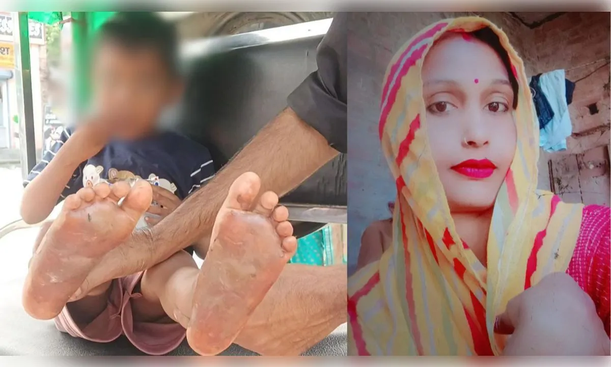 5 रुपये की टॉफी खाने पर तालिबानी सजा, मां ने गर्म चाकू से दागे बेटे के पैर