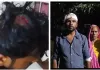 जानलेवा हमले के बाद भी एफआईआर नहीं, एसपी के दरबार पहुंचा पूरा परिवार