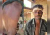 जुए के विवाद ने लिया हिंसक रूप, रेलवे लाइन किनारे मरणासन्न छोड़ भागे आरोपी