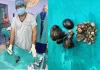 एसआरएन अस्पताल में जटिल ऑपरेशन, किडनी से निकालीं 37 पथरियां