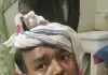 निर्माणाधीन पुल से लोहे का पाईप गिरने से श्रमिक घायल