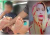 5 रुपये की टॉफी खाने पर तालिबानी सजा, मां ने गर्म चाकू से दागे बेटे के पैर