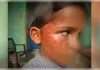 शिक्षक ने कराया छात्र की आंखों का इलाज