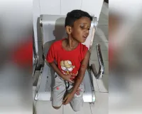 भागलपुर: खेल रहे मासूम पर कुत्ते ने किया हमला, कई जगह काटकर किया घायल
