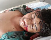 कार ने तीन दोस्तों को मारी टक्कर, एक युवक की मौत, एक अन्य गंभीर