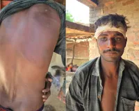 जुए के विवाद ने लिया हिंसक रूप, रेलवे लाइन किनारे मरणासन्न छोड़ भागे आरोपी