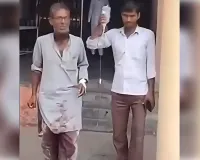बहू ने ब्लेड से काट दिया ससुर का गुप्तांग