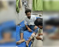 फर्रुखाबाद में सर्पदंश से पीड़ित दोस्त के साथ जिंदा सांप लेकर अस्पताल पहुंचा युवक