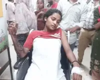 फरीदाबाद : युवती को बंधक बनाकर खौलते पानी से जलाया, दिल्ली रैफर