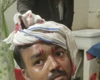 निर्माणाधीन पुल से लोहे का पाईप गिरने से श्रमिक घायल