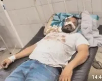 मामूली कहासुनी के बाद युवक के सिर पर चापड़ से हमला