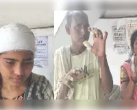 रंजिश में दबंगों ने पति-पत्नी व बेटी को पीटा, मुकदमा‌ दर्ज