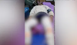 तिलक नगर मुस्कान हत्याकांड: मुठभेड़ के बाद आरोपी जिम ट्रेनर इमरान गिरफ्तार