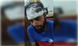 घरेलू विवाद में पिता- बेटे में नोकझोंक, बेटे पर लोहे के सरिए से हमला