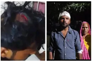 जानलेवा हमले के बाद भी एफआईआर नहीं, एसपी के दरबार पहुंचा पूरा परिवार