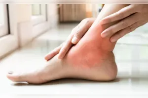 जवानी में कमजोर हो रहे हैं पैर, सूजन, दर्द और चलने फिरने में परेशानी