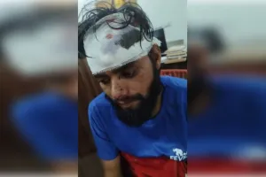 घरेलू विवाद में पिता- बेटे में नोकझोंक, बेटे पर लोहे के सरिए से हमला