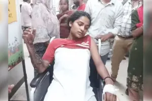 फरीदाबाद : युवती को बंधक बनाकर खौलते पानी से जलाया, दिल्ली रैफर