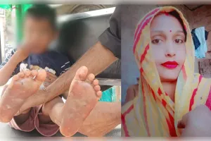5 रुपये की टॉफी खाने पर तालिबानी सजा, मां ने गर्म चाकू से दागे बेटे के पैर