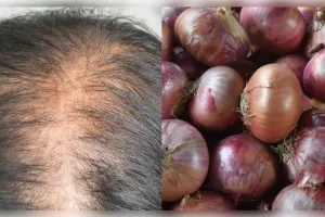 नींबू और प्याज क्या वाकई इनका इस्तेमाल बालों के लिए फायदेमंद है? 