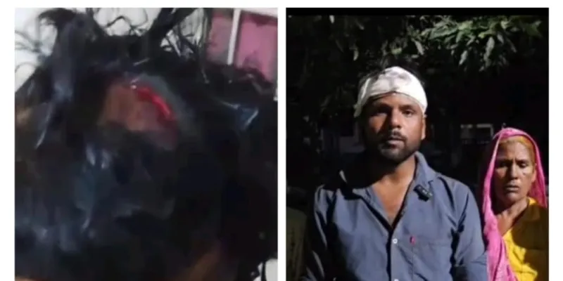 जानलेवा हमले के बाद भी एफआईआर नहीं, एसपी के दरबार पहुंचा पूरा परिवार