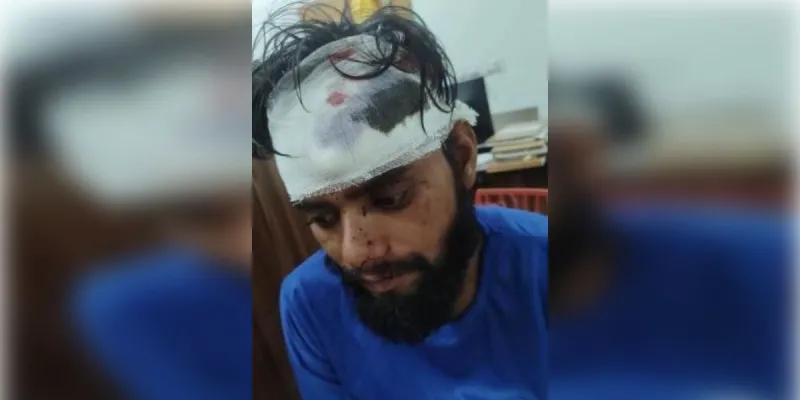 घरेलू विवाद में पिता- बेटे में नोकझोंक, बेटे पर लोहे के सरिए से हमला